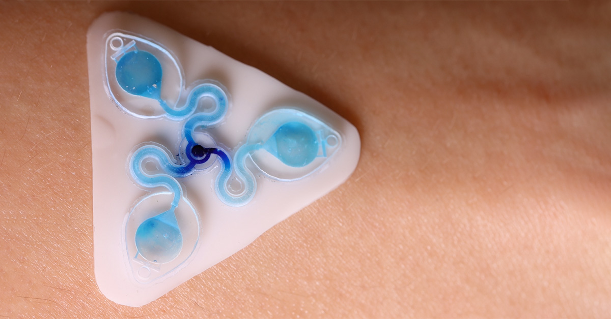 3D printed epifluidic devices called the Sweatainer. Developed by the Ray Research Group.