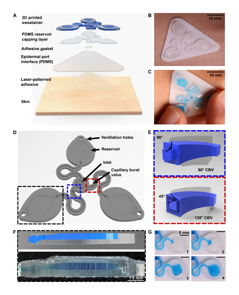 Figure 1. Schematic illustrations and optical images of the 3D printed epidermal microfluidic devices for the collection and analysis of sweat. (A) An exploded render highlights key components of the sweatainer system and epidermal interface (port). PDMS, poly(dimethylsiloxane). (B) A photograph of the sweatainer mounted on the ventral forearm of an individual before the onset of sweat collection. (C) The construct of the sweatainer eliminates uncontrolled fluid transport under mechanical loading (e.g., finger pressure and device removal). (D) Illustration of the sweatainer highlighting key device aspects including the inlet, capillary burst valves (CBVs; blue and red dashed area), collection reservoir, and ventilation holes to eliminate backpressure. (E) Renders of three-dimensional (3D) CBV designs enabled by 3D printing with diverging angles of 90° (top) and 135° (bottom). (F) 3D printing enables fabrication of device geometries in a true 3D space as shown by the computer-aided design (CAD) render (top) and photograph of actual device (bottom). Location of sweat appears in blue. (G) Photographic sequence highlighting the complete filling of a sweat collection reservoir.