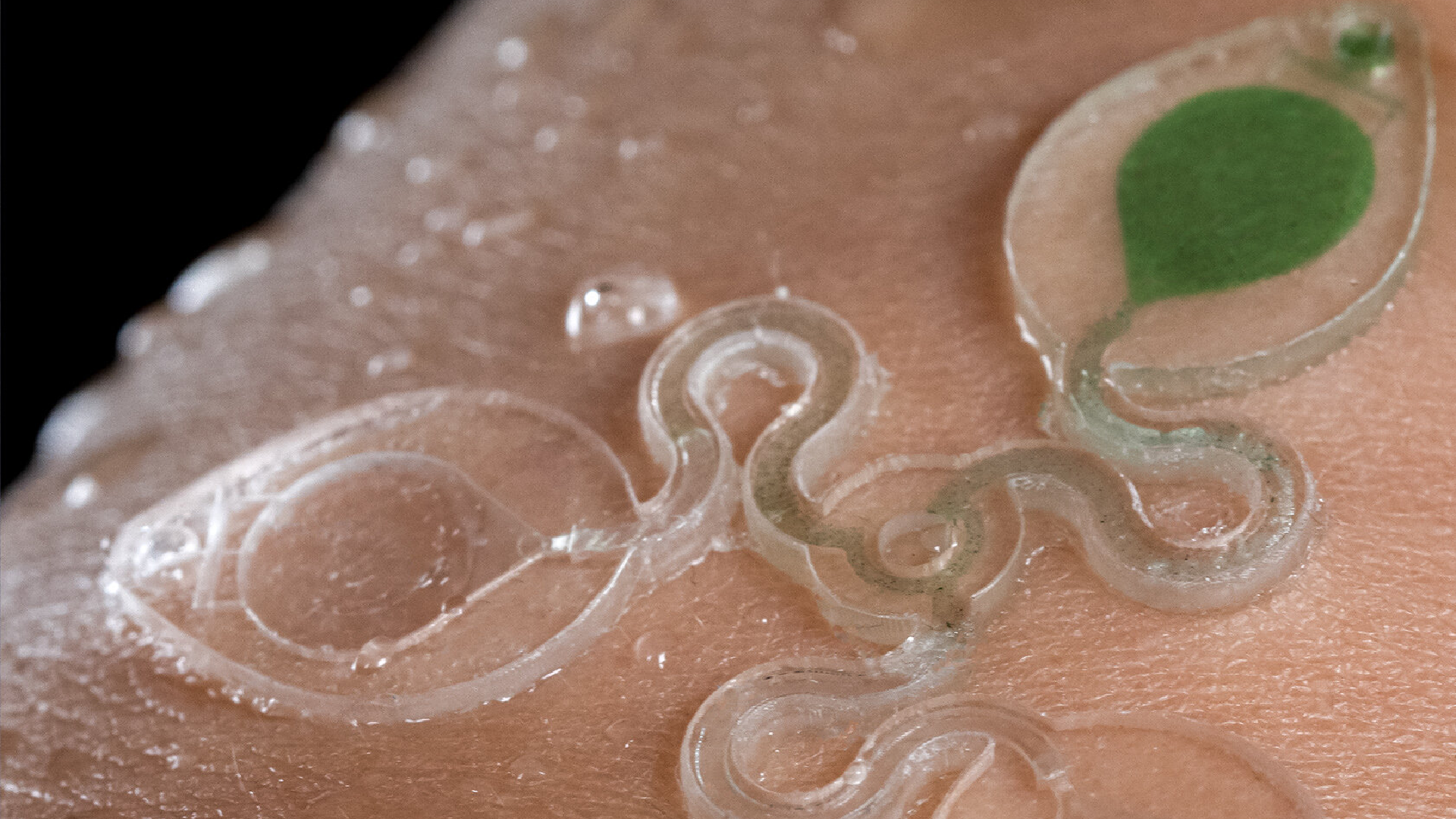 A 3D printed epifluidic device called a "sweatainer" used for sweat capture and analysis