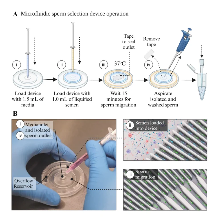 Figure 1. Overview of the microfluidic device selection process. (A) Schematic representation of the stages of operation of the microfluidic device. (i) Loading the device with media from the centre outlet, (ii) raw semen is then loaded into the outer inlet to create the semen–media interface, (iii) the centre outlet is sealed with tape and the device is left untouched for 15 min, and (iv) the tape is removed, and isolated and washed sperm are aspirated from the centre well ready for assessment and use. (B) A representative image of the microfluidic sperm selection device pre-loading with gamete buffer labelled with the key stages of device operation. Red sperm and round cells indicate non-motile cells and debris, blue sperm represent low motility sperm, and green sperm represent highly motile sperm.